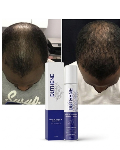 DUTHENE Sérum capillaire